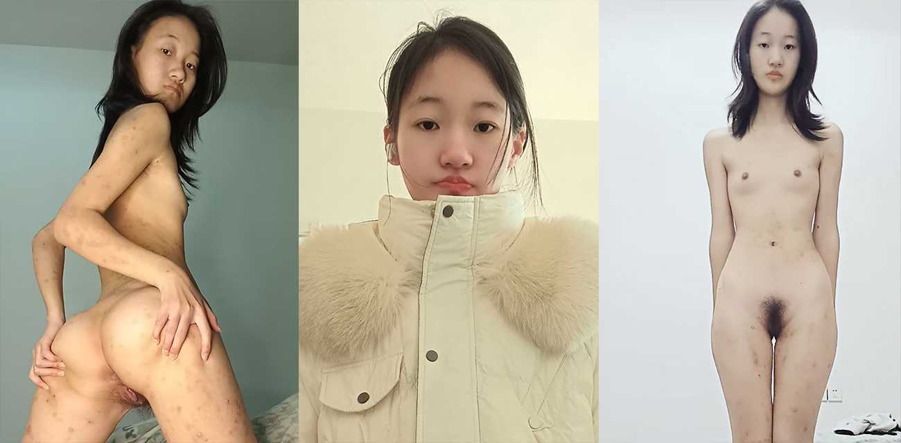 &#23665;&#19996;&#20020;&#27778;&#30005;&#23376;&#31185;&#25216;&#23398;&#38498;&#39118;&#39578;&#23398;&#22969;&#12304;&#24352;&#38639;&#23071;&#12305;&#32422;&#28846;&#25104;&#30270;&#33050;&#36367;&#22810;&#33337;&#36523;&#26579;&#24615;&#30149;&#20840;&#36523;&#28291;&#28866;&#36824;&#33258;&#24944;&#25187;&#31348;